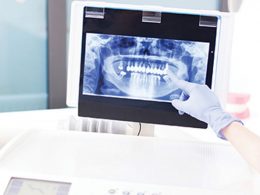 X-Işınlarının Teknolojideki Kullanım Alanları X-Işınlarının Teknolojideki Kullanım Alanları