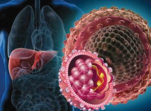 Hepatit Hastalığı Nedir, Korunma Yolları Nelerdir?