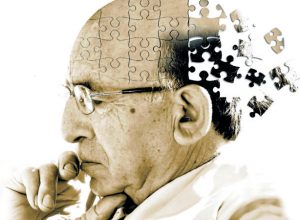 Alzheimer Nedir, Belirtileri Nelerdir?