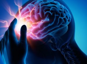 Epilepsi (Sara) Nedir, Belirtileri Nelerdir?