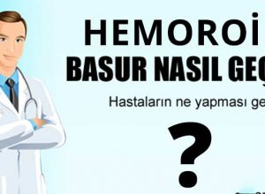 Hemoroid Tedavisi